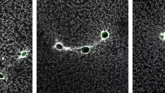 Microscope image of fibroblast cells