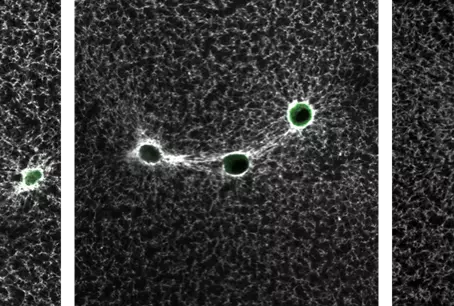 Microscope image of fibroblast cells